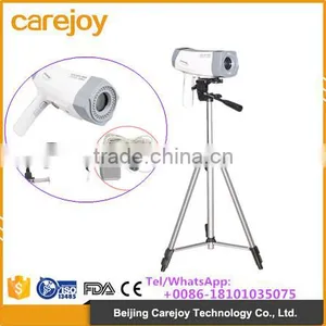 New Electronic Digital Video Colposcope Sony Camera for Vagina thumbnail-1