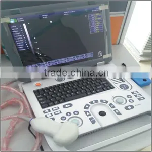 (MSLCU18)3D 4D Handheld Color Doppler Medical Ultrasound Scan Machine thumbnail-3