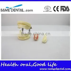 Dental Implant Practice Model DEA-31 Teeth Implant Models thumbnail-5