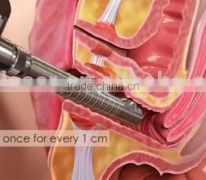 Newest Professional Fractional CO2 10600nm Laser Female Orgasm Device Vaginal Lasers Korea thumbnail-3