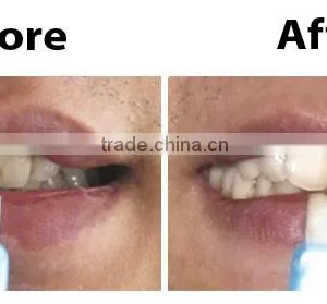 Magic Brush Teeth Cleaner thumbnail-2