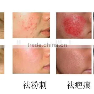 Fractional RF Freckle Remova Machine With 64 Matrix Points for Salon , Clinic thumbnail-6