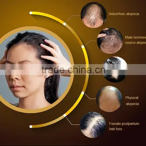 2016 Sunray New Arrival Laser Comb Massager for Stimulate Hair Growth Electric Scalp Stimulator thumbnail-2