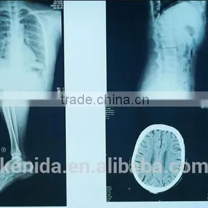 Agfa Film Dt2b 2015 New Product Cheap Dry Film Agfa X-ray Film thumbnail-1