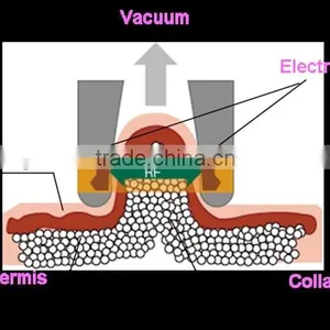The Weight Loss and Body Shape Machine thumbnail-1