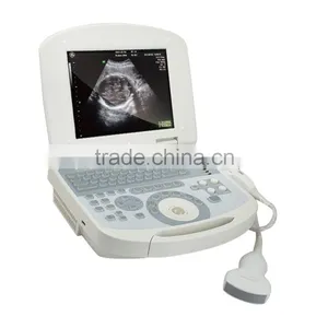 10 Inch Portable Ultrasound Scanner USG Machine With 3.5Mhz Convex Probe for OB/GYN Urology Etc thumbnail-4