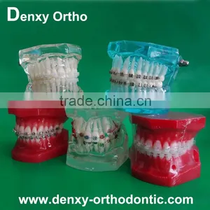 Differnt Types OEM Dental Orthodontic Study Model thumbnail-1