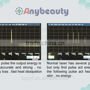 1000W Anybeauty 2016 Picosecond Q Switch Nd Yag Single Pulse Laser Tattoo Removal Machine 1500mj thumbnail-2