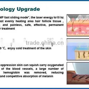 Real Factory Supply High Quality Diode Laser Hair Removal 808nm(CE,ISO13485,ROHS,TUV,BV) thumbnail-4