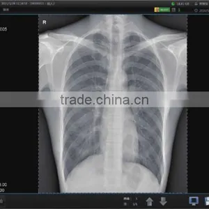 Wired or Wireless High Resolution Flat Panel Detector for Sale thumbnail-3