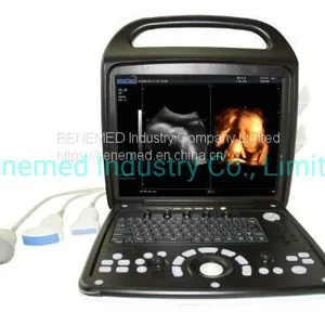 Premium 4D Color Doppler Ultrasound Scanner thumbnail-1