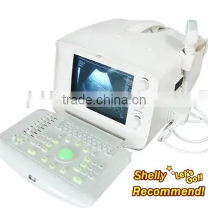 2016 CE Approved Hot Sale Price of Portable Ultrasound Scanner/Machine With Low Price-Shelly thumbnail-1