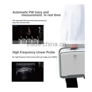 Laptop Color Doppler Ultrasound Price & Portable Color Doppler Ultrasound Machine thumbnail-2