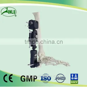 Distal Tibial Fragment External Fixator Orthopedic External Fixation thumbnail-1
