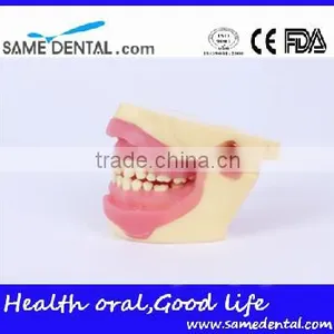 NISSIN Anesthesia Extraction Model School Teaching Demonstration thumbnail-3