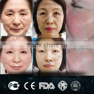 2016 Hot Sale Ultrasonic rf Vacuum Cavi Tation System Slimming Machine ,cavi Tation Machine Price thumbnail-4