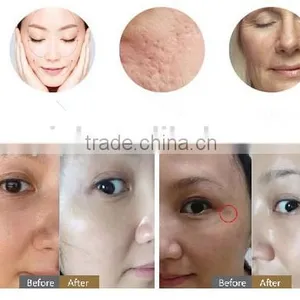 3in1 Machine Best Professional Multifunction Picos Laser Machine thumbnail-2