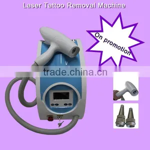 Discount Ipl Shr Laser Fast Tattoo Removal SHR thumbnail-1