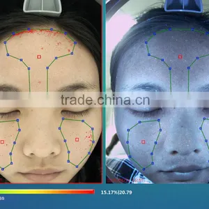 High Pixel Skin Pigmentation/acne/spot/pore/wrinkle/roughness/sensitivity/cosmetics Test Machine thumbnail-5
