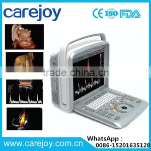 2016 New Portable Color Doppler(Optional 4D) for Cardiac Use thumbnail-1