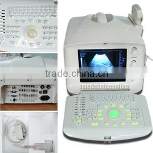 Low Price Portable Ultrasound Scanner 10 Inch With Convex Probe Optional High Frequency Linear Probe RUS-6000A thumbnail-1