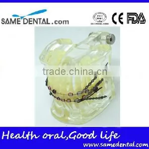 Dental Model Transparent Orthodontic Models Dental Eduction Assitant No. DEA-08 thumbnail-2
