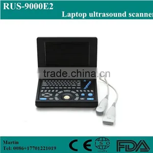 China Factory Low Price Mini Laptop Portable Ultrasound Scanner Medical Price for Obstetrics and Gynecology Examine From China thumbnail-1