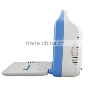 New Portable Full Digital Color Doppler Ultrasound Scanner Diagnostic System 2 Probe With Cheap Price thumbnail-6