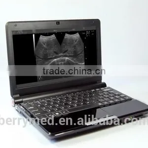 Health&Medical Equipment B/W Portable Ultrasound Scanner thumbnail-1
