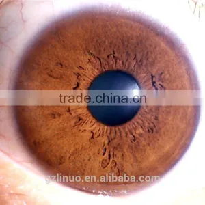 Wholesale Price 5MP Pixel Iridology Analyzer Camera thumbnail-6