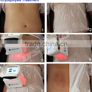 Double Chin Removal Med Spa Cool Shape Cryolipolysis Body Contouring Machine Body Contouring thumbnail-5