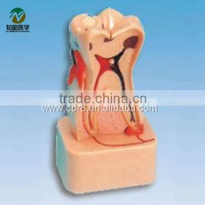 BIX-L1004 Teeth Lesions Comprehensive Pathological Decomposition Model thumbnail-1
