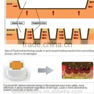 Professional Microneedle Rf/best rf Skin Tightening Face Lift Machine/micro rf Deep Wrinkle Removal thumbnail-5