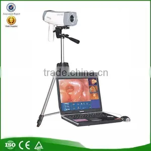 Electronic Colposcope RCS-400 Digital Vaginal Mirror SONY 800,000 Pixels thumbnail-1