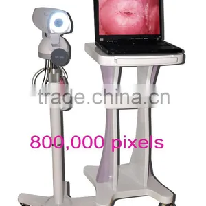 Digital High-Pixel Electronic Colposcope(RCS-500) thumbnail-1