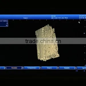 CE Approved Laptop PC Platform 3D Image Ultrasound Machine/Scanner With 3.5Mhz Convex Probe thumbnail-4