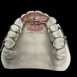 Porcelain Fused to Metal Lab From China thumbnail-3