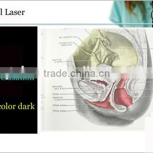 2015 Hot Sale Imported RF Tube Co2 Fractional Laser for Vaginal Treatment thumbnail-4