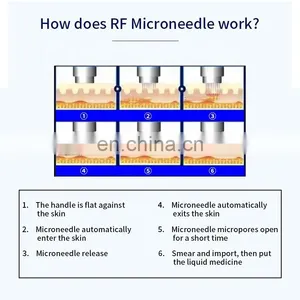 Gold RF Fractional Microneedle Machine Lifting Scars Wrinkles Remove Whitening Instrument Beauty Salon Skin Tightening Device thumbnail-3