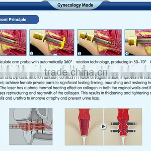 Most Advanced High Quality Beauty Equipment 10600 nm Laser Co2 Surgical Laser With USA Tube thumbnail-6