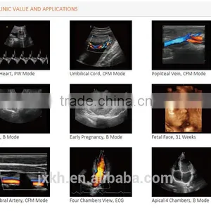 3D Trolley Ultrasound Scanner Color Doppler Ultrasound System (optional 4D) thumbnail-6