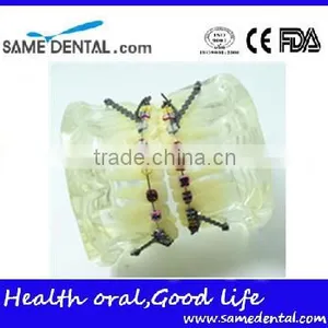 Dental Model Transparent Orthodontic Models Dental Eduction Assitant No. DEA-08 thumbnail-3