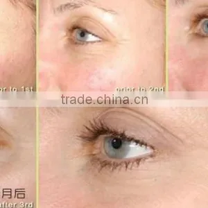 Notime 2016 Eye Wrinkle Eraser Pen Microcurrent Therapy Devices thumbnail-6