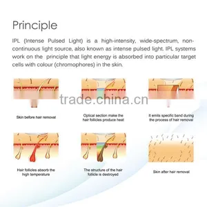 SMQ-NK Portable OPT Shr Hair Removal Machine / IPL / OPT SHR thumbnail-4