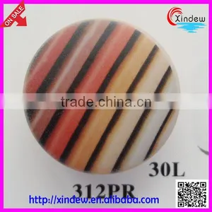 Fashion Design Plastic Printing Coat Buttons/shirt Buttons/High-end Clothing Buttons/Senior Custom Buttons thumbnail-1