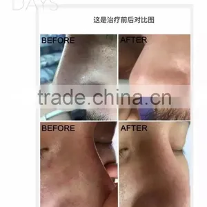 Beauty Salon Machine Water Oxygen Jet thumbnail-5