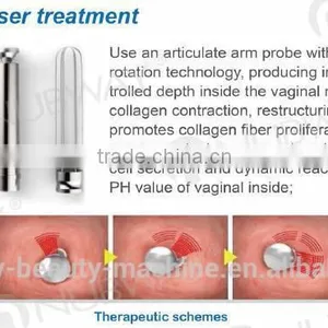 Eliminate Body Odor Plastic Surgery Fractional Co2 Laser Machine/ Warts Removal Vaginal 0.1mj-300mj Tightening Laser Eye Wrinkle / Bag Removal thumbnail-2