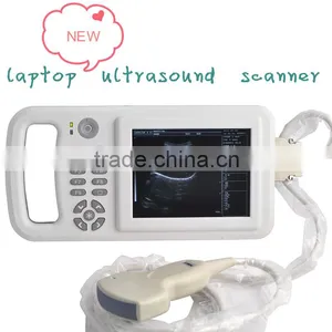6.5 Inch LCD With Clear Image Handheld Ultrasoud Scanner RUS-8000A thumbnail-1