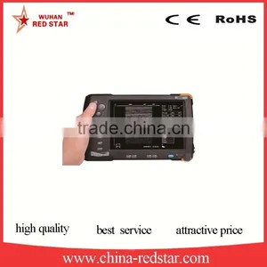 Poultry Farming Veterinary Ultrasound Scanner Equipment thumbnail-1