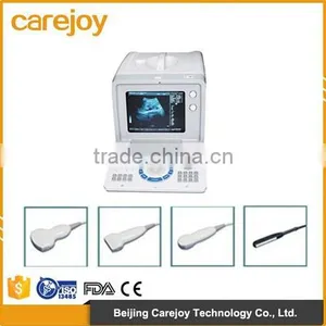 Cheap Portable Ultrasound Machine Ultrasonic Diagnostic Scanner With Convex Linear Transvaginal Rectal Probe Optional thumbnail-1